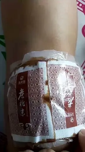 我的膏药太管用了